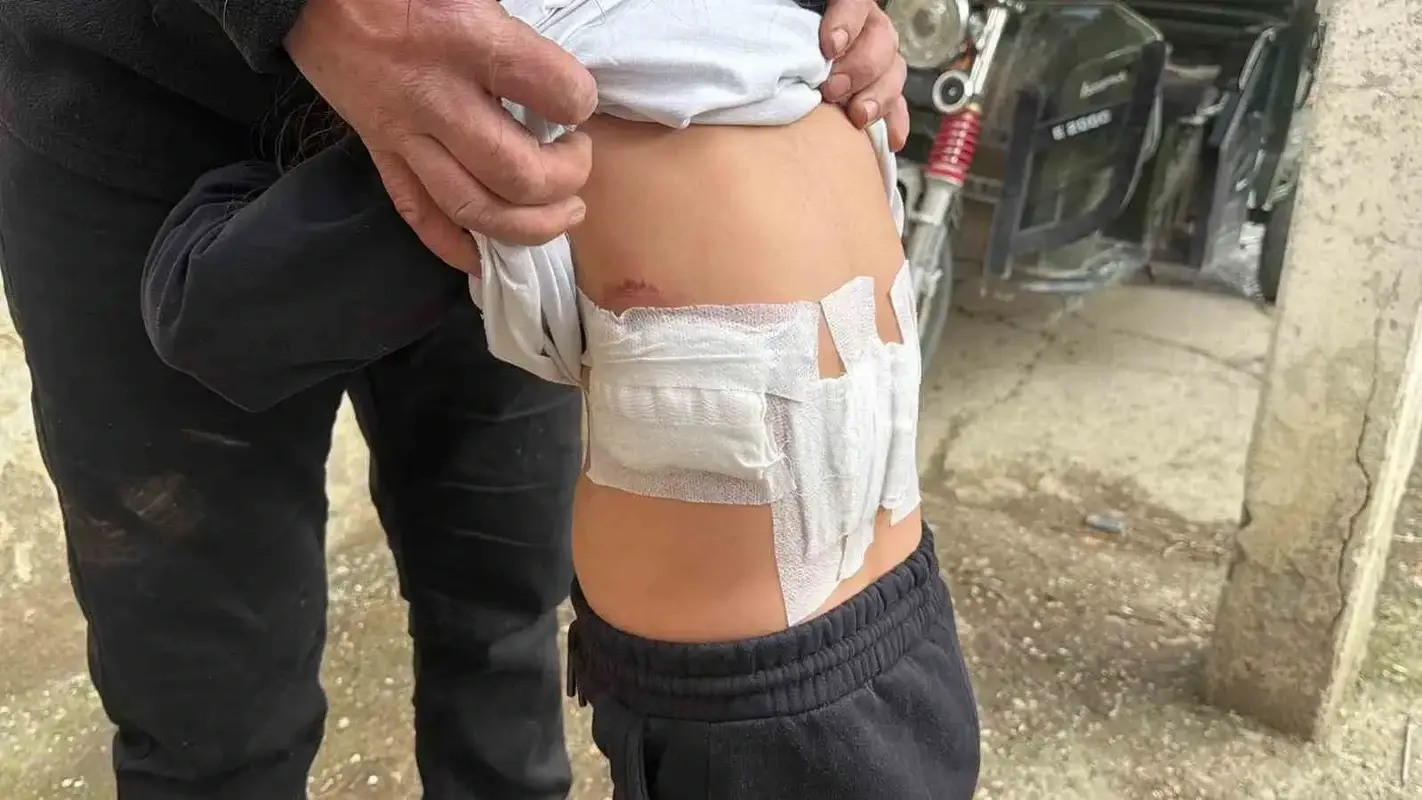 Afyonkarahisar’da saldırgan eşek dehşeti: 5 yaşındaki çocuğa kabusu yaşattı